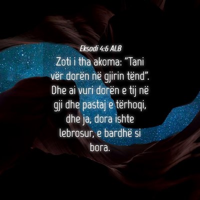Picture 04 - Eksodi 4:6 ALB - Zoti i tha akoma: 